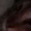 scar