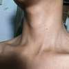 khant